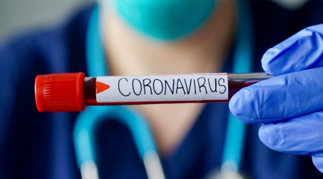 İngiltere'de 741 bin adet korona virüs testinde güvenlik endişesi