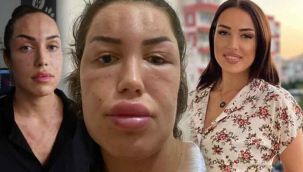 İzmirli genç kadının hayatı 'gençlik aşısı' ile karardı