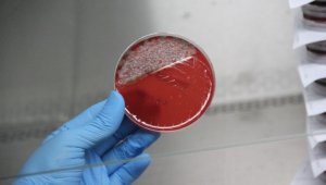 Uzun süre kullanılan maskede bu kadar bakteri birikiyor