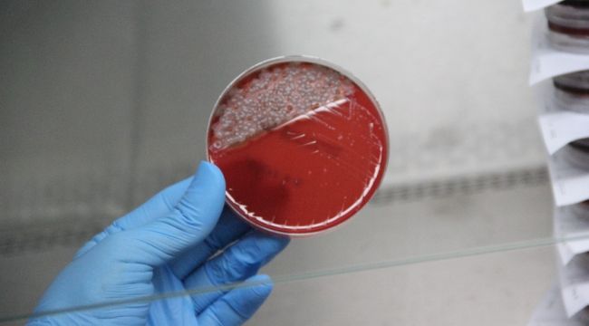 Uzun süre kullanılan maskede bu kadar bakteri birikiyor