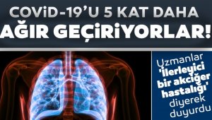 O hastalar, COVID-19'u 5 kat daha ağır geçiriyor