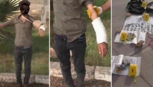 Terörist bombayı kolundaki alçıda kamufle etmiş