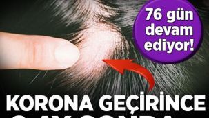 Koronavirüs saç dökülmesi yapar mı? 