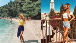 Manken hastalığından öldü