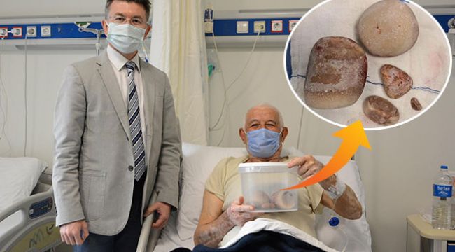 Mesanesinden çıkan 2.5 kilo ağırlığındaki taşları hatıra olarak aldı