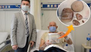 Mesanesinden çıkan 2.5 kilo ağırlığındaki taşları hatıra olarak aldı