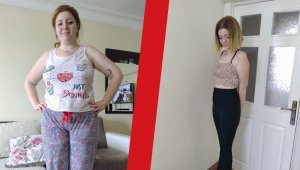 Tüp mide ameliyatı oldu arkadaşları bile tanıyamadı