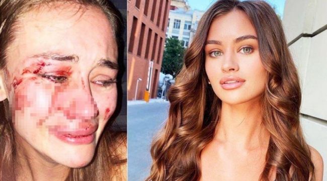 Ukraynalı model Daria Kyryliuk kendisini dövenleri affetti