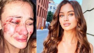 Ukraynalı model Daria Kyryliuk kendisini dövenleri affetti