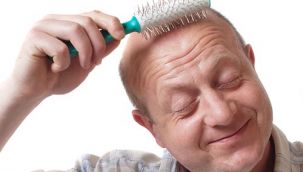 Bilim adamları: Kelliğe çare bulduk