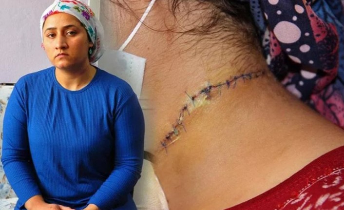 "Boğazımı kesti, hala tehdit ediyor!"