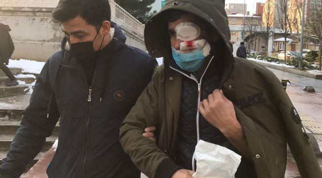 Buz sarkıtı bu hale getirdi