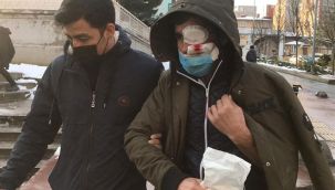 Buz sarkıtı bu hale getirdi