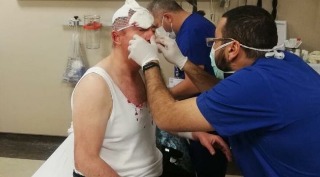 Dehşet anları! Genel Başkan Yardımcısına silahlı saldırı