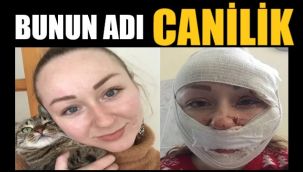 Eşinin yüzünü ne hale getirdi