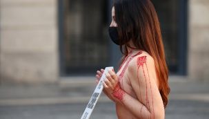 Hayvan hakları savunucusundan çıplak protesto