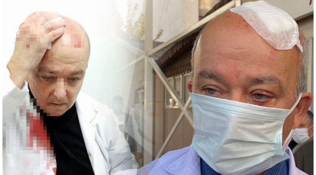 Öldürse miydi? Doktorun kafasını yaran serbest!