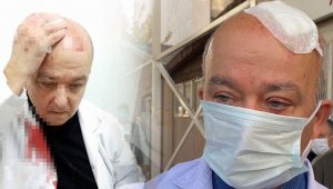 Öldürse miydi? Doktorun kafasını yaran serbest!