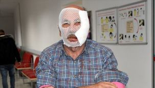 Torunlarını korumak isterken ne hale geldi!