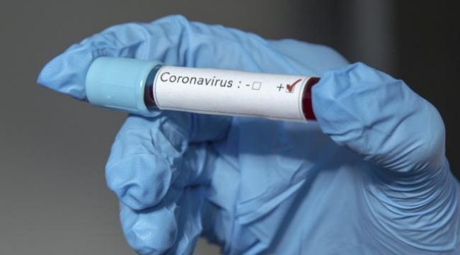 Virüsten "büyülü iksir" ile korunduğunu söyleyen Sağlık Bakanına korona şoku