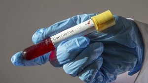 KKTC'de son 24 saatte 42'si yerel 65 yeni vaka