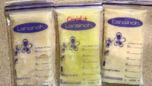 Koronalı annenin sütü böyle renk değiştirdi