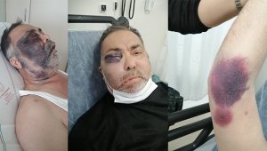 Yüzde 90 engelli adamı öldüresiye darp ettiler