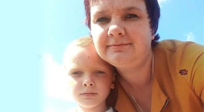 8 yaşındaki çocuğunun boğazına benzin döküp ateşe verdi!