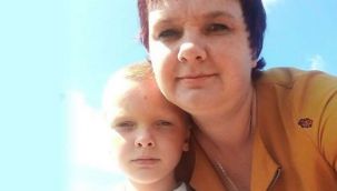 8 yaşındaki çocuğunun boğazına benzin döküp ateşe verdi!