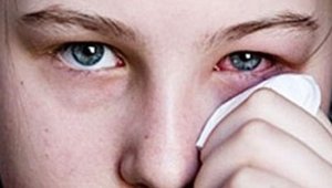 Baharda göz alerjisine dikkat