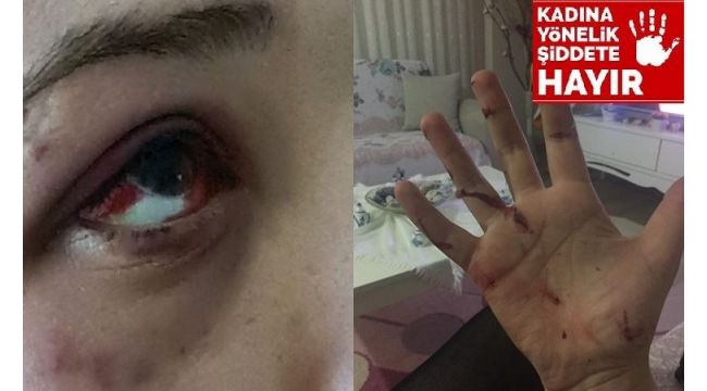 Genç kızı bu hale bir avukat getirdi