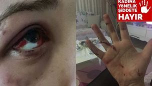 Genç kızı bu hale bir avukat getirdi