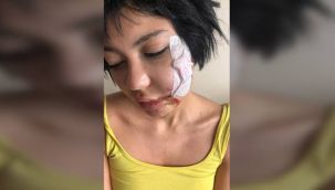 Neden saldırıya uğradığı anlaşıldı