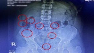 Uyuşturucular röntgenle çıktı