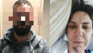 Ayrılmak isteyen sevgilisi sarılıp korona bulaştırmak istemiş!