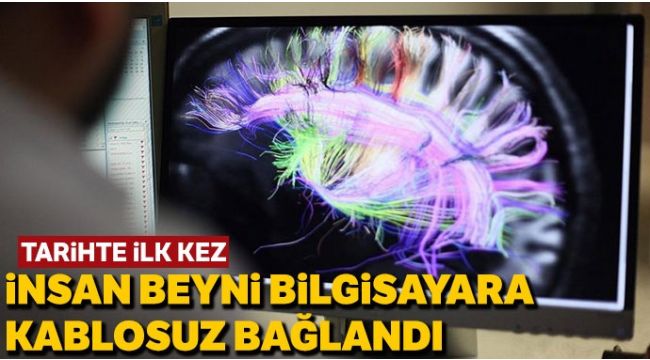 Bilim insanları tarihte bir ilki gerçekleştirdi