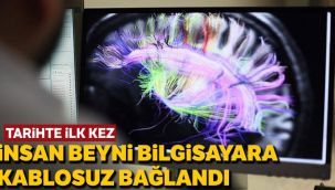 Bilim insanları tarihte bir ilki gerçekleştirdi