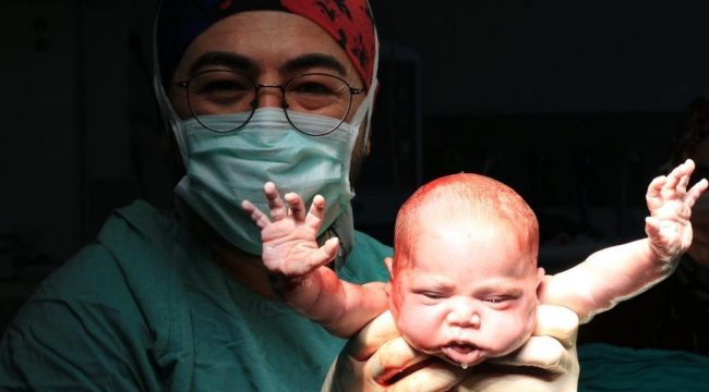 Burçak bebeğin fotoğrafıyla dünya birincisi oldu