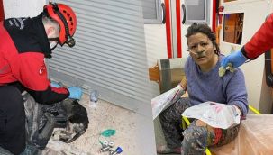 Kedisini kurtarmak isterken vücudu yandı