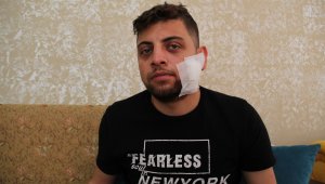 Kadına tokat atanı uyardı, hastanelik oldu