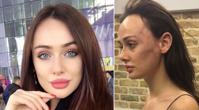 Sırp modele dayak davasında gelişme