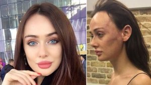 Sırp modele dayak davasında gelişme