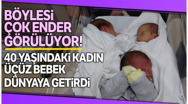 Doktorları şaşırtan doğum