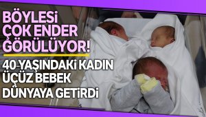 Doktorları şaşırtan doğum