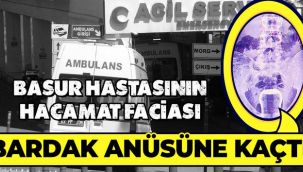 Hacamat kazası! Yağlı çay bardağı anüsüne kaçtı
