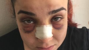 Telefonla konuştuğu için çalışanını darp etti