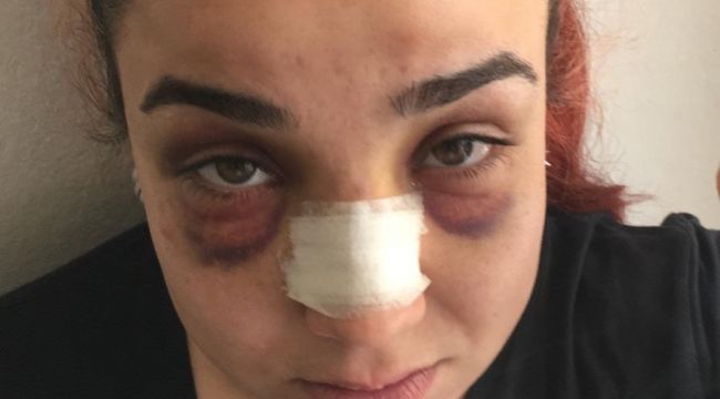 Telefonla konuştuğu için çalışanını darp etti