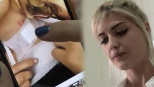 "Yalvarırım beni öldürme"