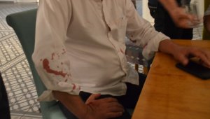 Belediye Başkanına beyzbol sopalı saldırı