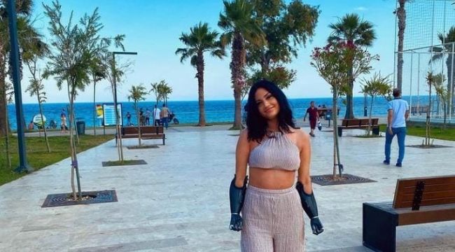 Gurbetçi genç kız, çift kol nakli olacak